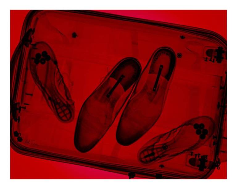 Baggage - Hugh Turvey