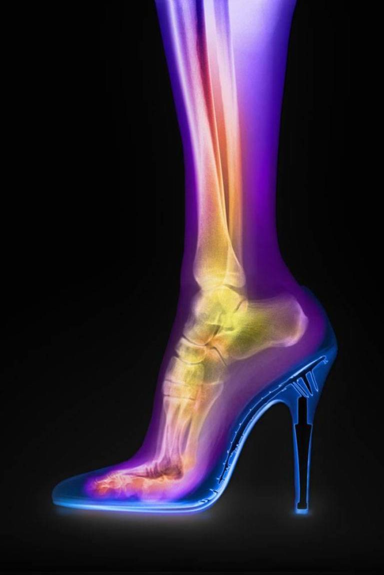 Femme Fatale (Artemi) - Hugh Turvey