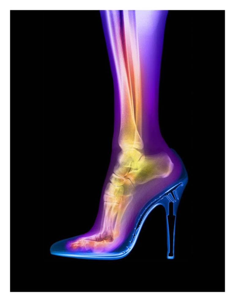 Femme Fatale (Artemi) - Hugh Turvey