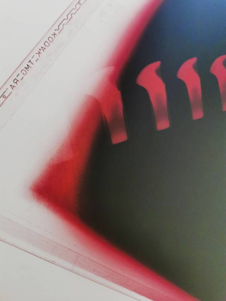 XXX Zip - Hugh Turvey